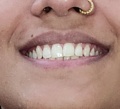 Dr. Agarwal's Multispeciality Dental Clinic & Implant Centre