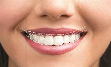 Cosmetic dentists / Smile design
